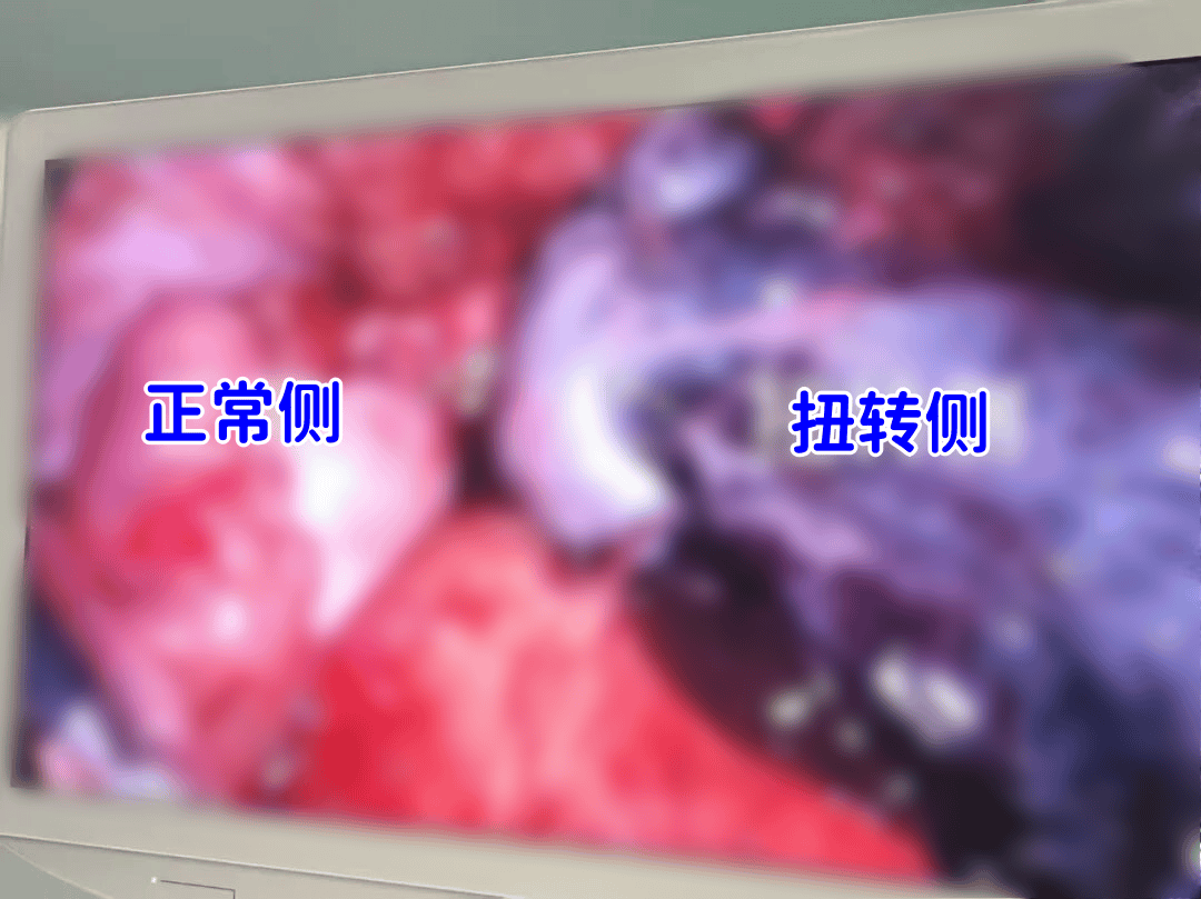 太可怕！10歲女孩差點失去卵巢！極易被誤診<strong></p>
<p>中航光電科技股份有限公司
</strong>，這種情況家長需馬上送醫:中航光電科技股份有限公司
